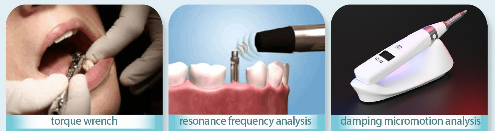 YAHOPE iCHECK Implant Stability Meter Dental Implant Osseointegration Monitor 